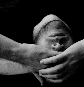 Hypersomnia Image