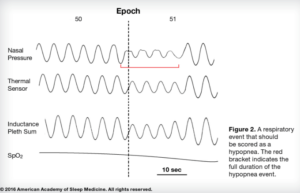 Hypopnea Scoring Criteria Image